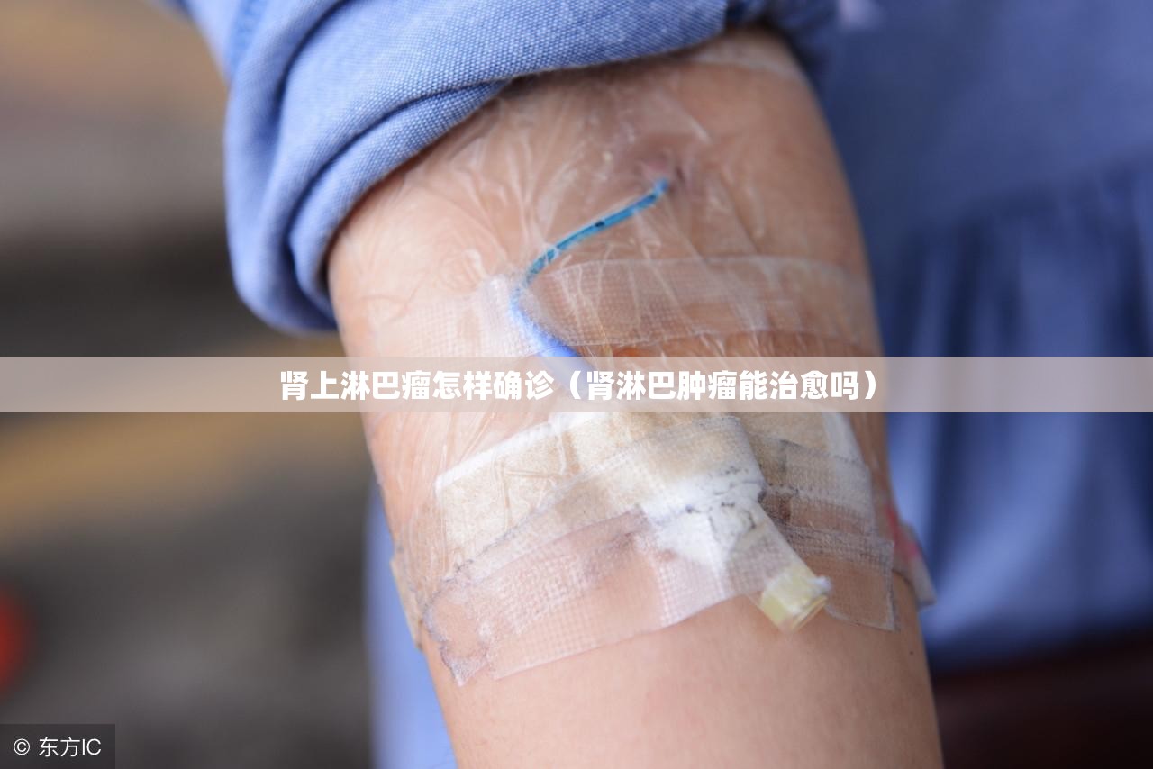 肾上淋巴瘤怎样确诊(肾淋巴肿瘤能治愈吗) 肾上淋巴瘤怎样确诊(肾淋巴肿瘤能治愈吗)