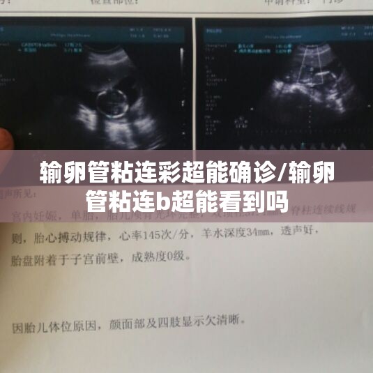 输卵管粘连彩超能确诊/输卵管粘连b超能看到吗 输卵管粘连彩超能确诊/输卵管粘连b超能看到吗