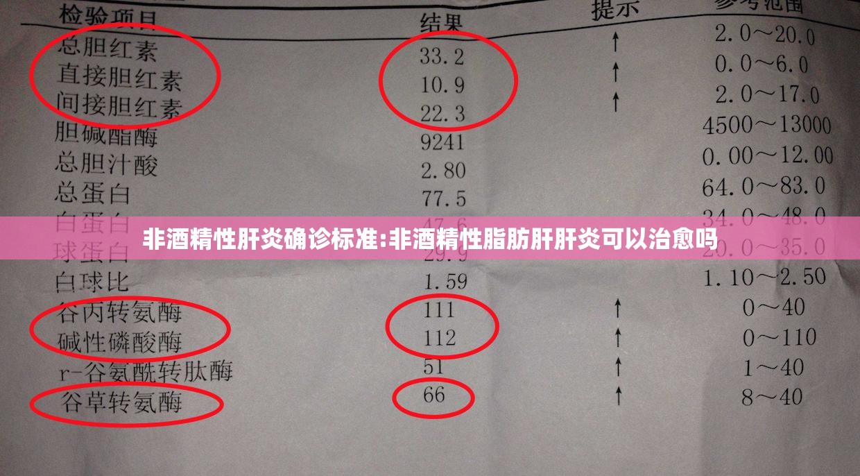 非酒精性肝炎确诊标准:非酒精性脂肪肝肝炎可以治愈吗