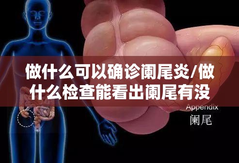 做什么可以确诊阑尾炎/做什么检查能看出阑尾有没有问题
