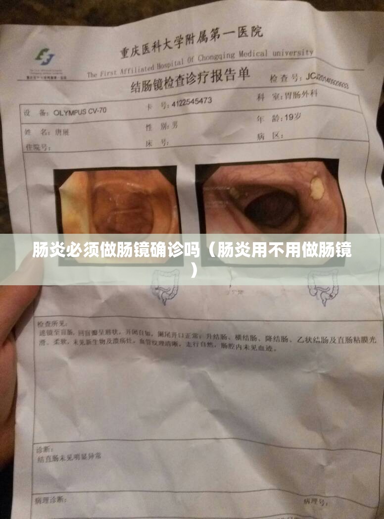 肠炎必须做肠镜确诊吗（肠炎用不用做肠镜）