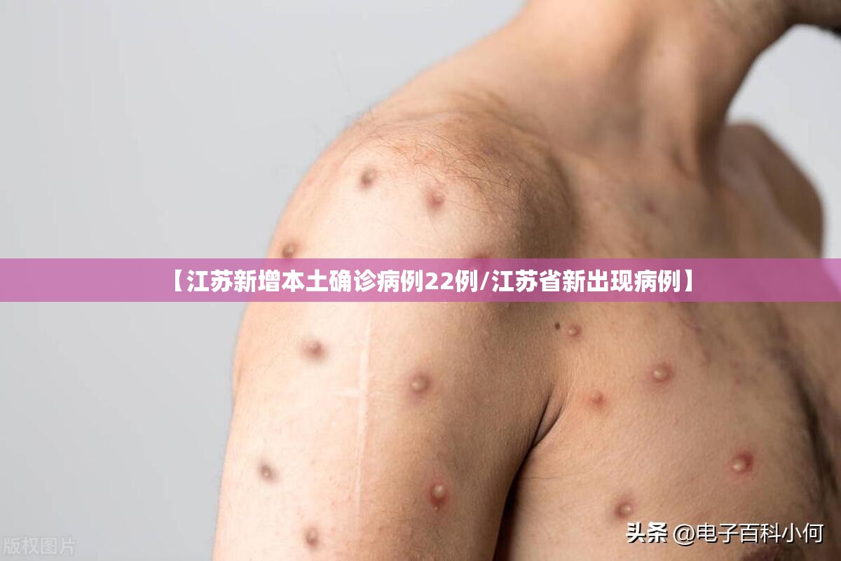 【江苏新增本土确诊病例22例/江苏省新出现病例】 【江苏新增本土确诊病例22例/江苏省新出现病例】
