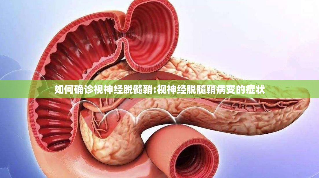 如何确诊视神经脱髓鞘:视神经脱髓鞘病变的症状 如何确诊视神经脱髓鞘:视神经脱髓鞘病变的症状