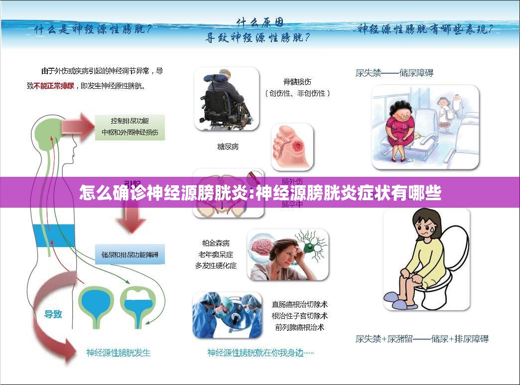 怎么确诊神经源膀胱炎:神经源膀胱炎症状有哪些 怎么确诊神经源膀胱炎:神经源膀胱炎症状有哪些