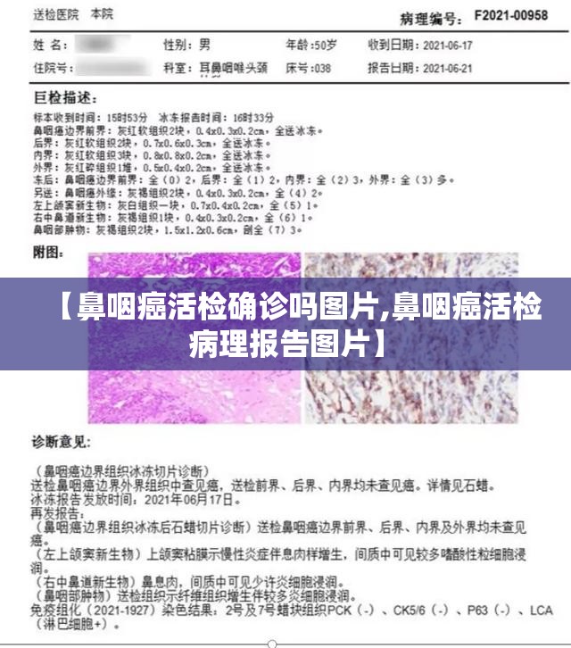 【鼻咽癌活检确诊吗图片,鼻咽癌活检病理报告图片】