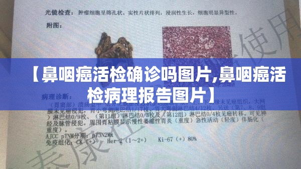 【鼻咽癌活检确诊吗图片,鼻咽癌活检病理报告图片】