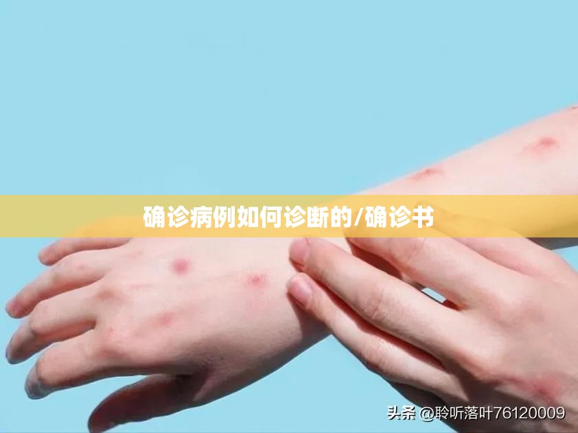 确诊病例如何诊断的/确诊书